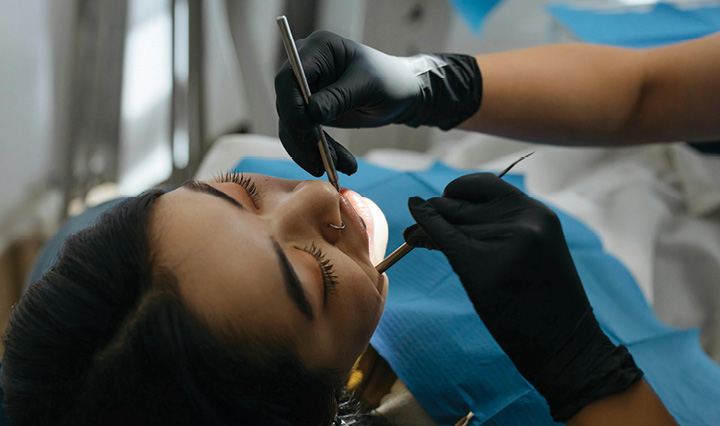 Dental Fillings / Teeth Fillings